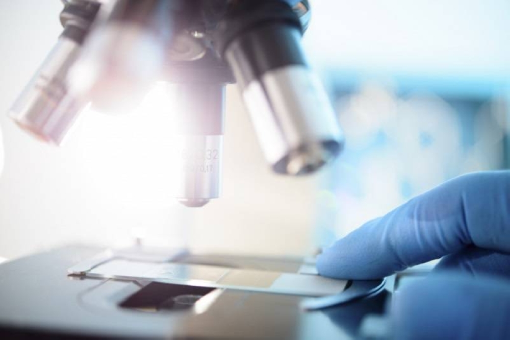 NPRA促请民众避免购买及使用两款含有违禁水银成份的美容护肤品。-法新社-