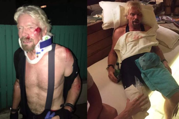 布兰森传出骑脚车发生意外，面颊与身体皆严重受伤。-图取自Virgin.com-