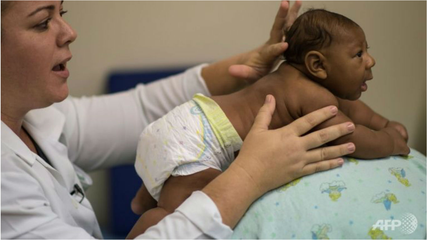 Microcephaly is a rare neurological disorder that causes a baby's head to be smaller than normal and prevents its brain from fully developing. (Photo: AFP/Christophe Simon)