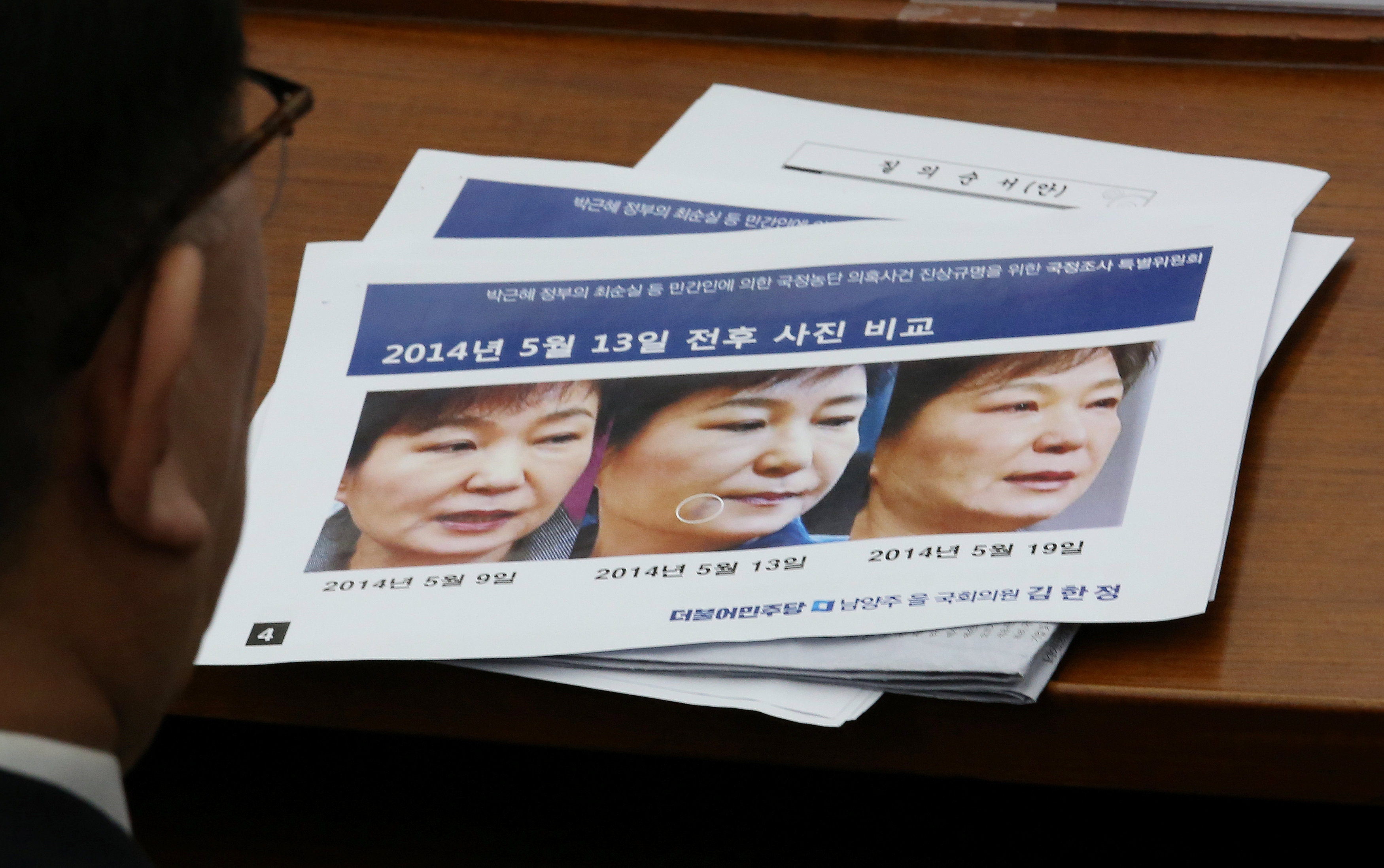 Kim Young-jae, who heads a hospital regularly visited by impeached President Park Geun-hye's longtime friend Choi Soon-sil, looks at impeached President Park Geun-hye's three pictures combo each taken on May 9th, May 13th, May 19, 2014 respectively, durin