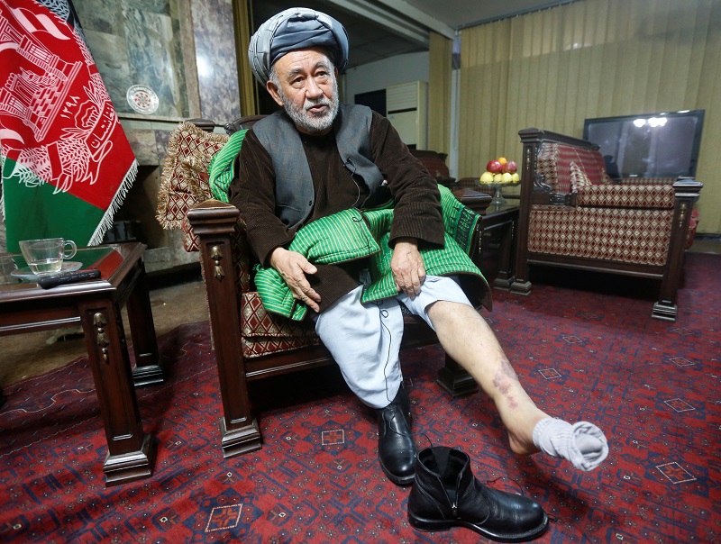 艾什奇周二在喀布尔的家中受访时，向媒体展示他腿上的伤。-路透社-