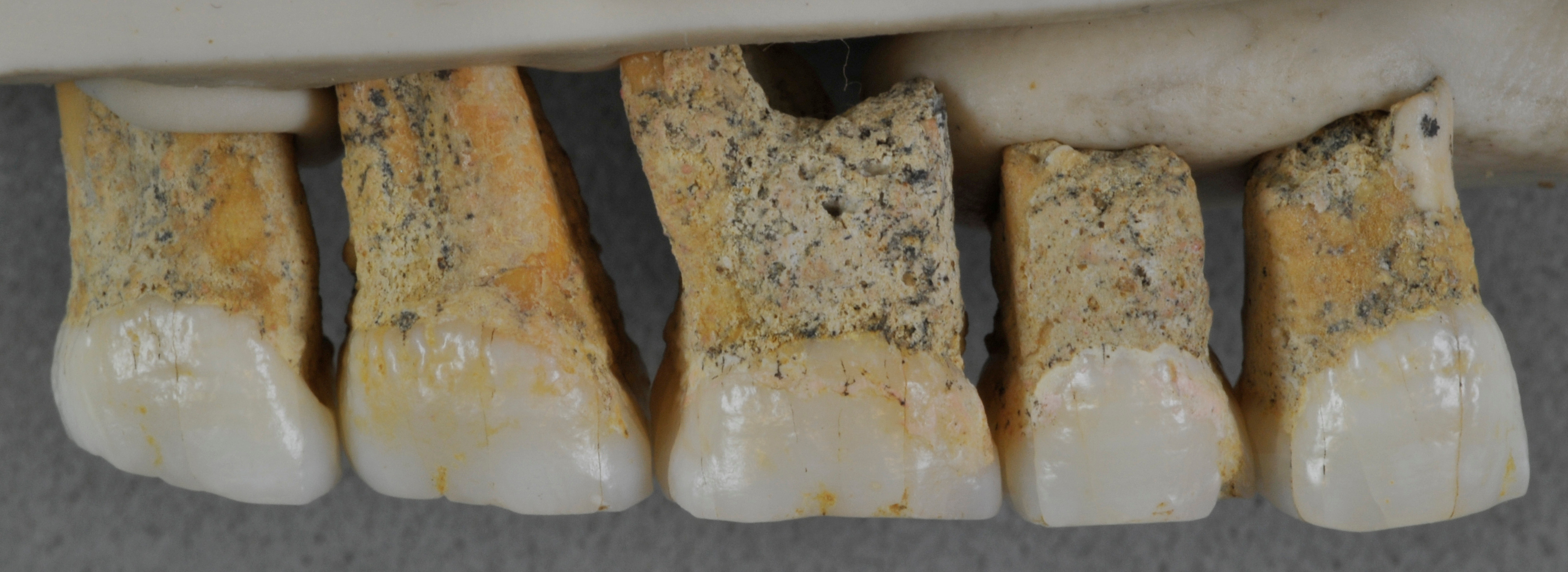 研究人员根据所找到的牙齿（图）和骨头推断，“吕宋古人类”的体型相对较小。-路透社-