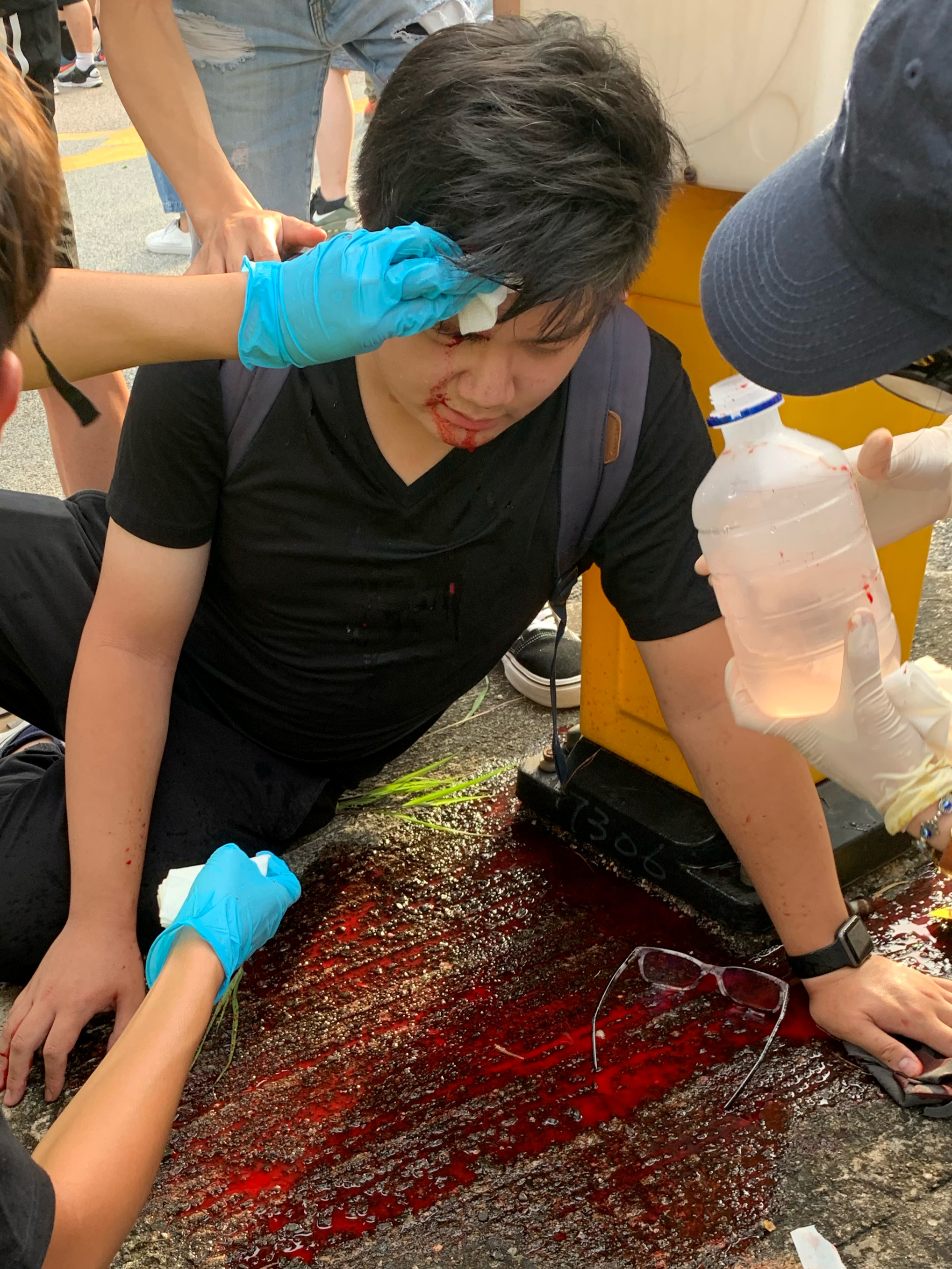 有示威者报称被硬物击中头部受伤流血，地上则留有大量血迹。-路透社-
