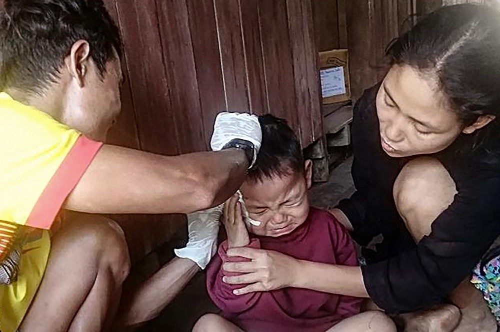 Toddler Saw Ta Eh Ka Lu Moo Taw (centre) receiving medical treatment in Day Pu No in Hpa-pun in eastern Myanmar's Karen state, on March 27.  u00e2u20acu201d Free Burma Rangers handout photo via AFP